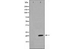 Western blot analysis on Jurkat cell lysate using Musculin Antibody,The lane on the left is treated with the antigen-specific peptide. (Musculin Antikörper  (Internal Region))