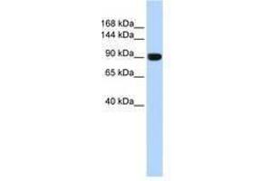 Image no. 1 for anti-Anoctamin 1, Calcium Activated Chloride Channel (ANO1) (AA 828-877) antibody (ABIN6740769) (ANO1 Antikörper  (AA 828-877))