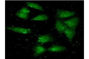 ICC/IF analysis of ALDH2 in A549 cells line, stained with monoclonal anti-human ALDH2 antibody (1:100) with goat anti-mouse IgG-Alexa fluor 488 conjugate (Green).
