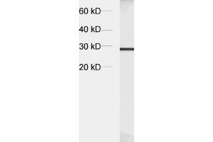 dilution: 1 : 5000, sample: crude synaptosomal fraction of rat brain (P2) (Synaptogyrin 1 Antikörper  (AA 220-234))