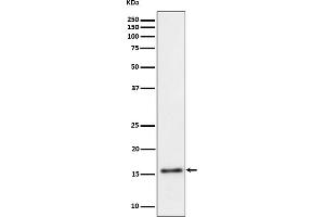 Western blot analysis of TRAPPC2 expression in Raji cell lysate.