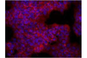 Immunofluorescence (IF) image for anti-Receptor tyrosine-protein kinase erbB-2 (ErbB2/Her2) antibody (ABIN2664603) (ErbB2/Her2 Antikörper)