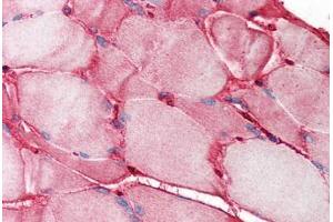 Human Skeletal Muscle (formalin-fixed, paraffin-embedded) stained with FN1 antibody ABIN214358 at 1. (Fibronectin 1 Antikörper)