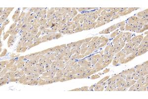 Detection of cTnI in Human Cardiac Muscle Tissue using Polyclonal Antibody to Cardiac Troponin I (cTnI) (TNNI3 Antikörper  (AA 1-203))