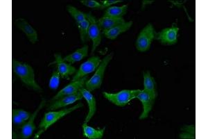 Immunofluorescent analysis of Hela cells using ABIN7144661 at dilution of 1:100 and Alexa Fluor 488-congugated AffiniPure Goat Anti-Rabbit IgG(H+L) (AHRR Antikörper  (AA 255-506))