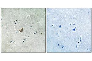 Immunohistochemical analysis of paraffin-embedded human brain tissue using EPHA3/4/5 (Phospho-Tyr779/833) antibody (left)or the same antibody preincubated with blocking peptide (right). (EPH Receptor A3 Antikörper  (pTyr779, pTyr833))