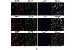 ABIN1 is colocated with A20 and NeuN and Iba-1, respectively, in the peri-infarct cortex. (TNIP1 Antikörper)