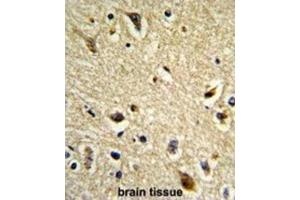 Immunohistochemistry (IHC) image for anti-Cytochrome P450, Family 2, Subfamily E, Polypeptide 1 (CYP2E1) antibody (ABIN3003847)