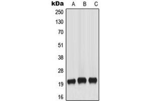 Western blot analysis of MART-1 expression in HeLa (A), A431 (B), WERI (C) whole cell lysates. (MLANA Antikörper  (Center))