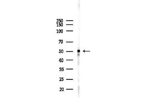 Western blot analysis of lysates from HepG2 cells(heat-shock,45 min treatment), using Phospho-Cytokeratin 8 (Ser432) Antibody at 1/1000 dilution.