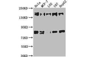 Western Blot Positive WB detected in: Hela whole cell lysate, MCF-7 whole cell lysate, L02 whole cell lysate, U87 whole cell lysate, HepG2 whole cell lysate All lanes: ZFYVE9 antibody at 1:1000 Secondary Goat polyclonal to rabbit IgG at 1/50000 dilution Predicted band size: 157, 151, 84 kDa Observed band size: 157 kDa (ZFYVE9 Antikörper  (AA 683-926))