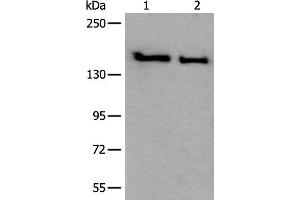 Western blot analysis of HUVEC and Jurkat cell lysates using SMC1A Polyclonal Antibody at dilution of 1:300 (SMC1A Antikörper)