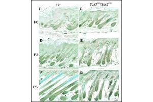 Immunohistochemistry (Paraffin-embedded Sections) (IHC (p)) image for anti-serum/glucocorticoid Regulated Kinase Family, Member 3 (SGK3) (AA 1-30), (N-Term) antibody (ABIN392462)