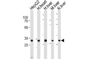 Western blot analysis of lysates from HepG2 cell line, human heart, human liver, mouse liver, rat liver tissue lysate (from left to right), using DECR1 Antibody (Center) (ABIN6243564 and ABIN6577825).