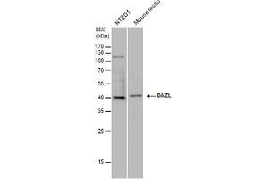 WB Image DAZL antibody detects DAZL protein by western blot analysis.