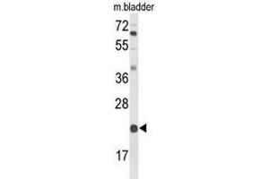 Western blot analysis of DGCR6 Antibody (Center) in mouse bladder tissue lysates (35µg/lane). (DGCR6 Antikörper  (Middle Region))