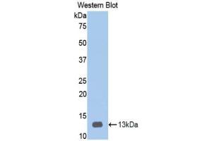 Western blot analysis of recombinant Human HPA. (HPSE Antikörper  (AA 34-115))