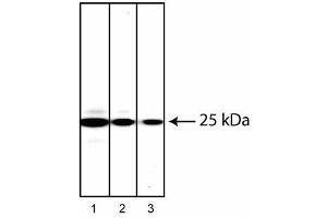 Western blot analysis of Rab27 in human chronic myelogenous leukemia. (RAB27A Antikörper)