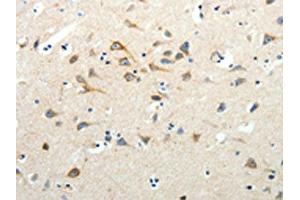 The image on the left is immunohistochemistry of paraffin-embedded Human brain tissue using ABIN7130975(SCG3 Antibody) at dilution 1/25, on the right is treated with fusion protein.