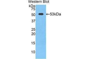 Western Blotting (WB) image for anti-Cathepsin K (CTSK) (AA 90-318) antibody (ABIN1858554) (Cathepsin K Antikörper  (AA 90-318))
