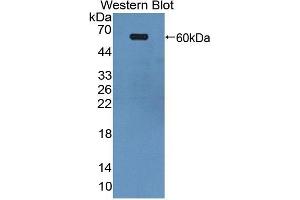 Detection of Recombinant EPHA4, Human using Polyclonal Antibody to Ephrin Type A Receptor 4 (EPHA4) (EPH Receptor A4 Antikörper  (AA 621-882))