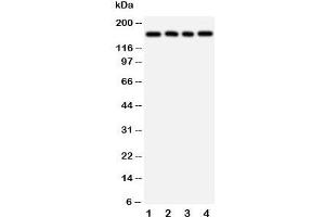Western blot testing of TNR antibody and Lane 1:  rat brain;  2: human U87;  3: (h) HeLa;  4: (h) MCF-7 cell lysate (Tenascin R Antikörper  (N-Term))