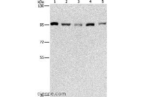Western blot analysis of HepG2, K562, Jurkat, 231 and hela cell, using MCM5 Polyclonal Antibody at dilution of 1:475 (MCM5 Antikörper)