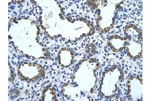 Rabbit Anti-GNAS Antibody       Paraffin Embedded Tissue:  Human alveolar cell   Cellular Data:  Epithelial cells of renal tubule  Antibody Concentration:   4. (GNAS Antikörper  (N-Term))
