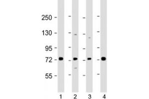Western blot testing of human 1) Raji, 2) A549, 3) HL-60 and 4) K562 cell lysate with SKI antibody at 1:2000.