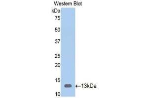 Western blot analysis of the recombinant protein. (Vitamin D-Binding Protein Antikörper  (AA 395-475))