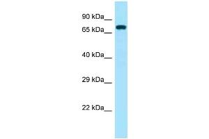 Western Blotting (WB) image for anti-zeta-Chain (TCR) Associated Protein Kinase 70kDa (ZAP70) (Middle Region) antibody (ABIN2788711) (ZAP70 Antikörper  (Middle Region))