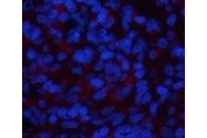 Immunofluorescence analysis of Rat spleen tissue using NBR1 Monoclonal Antibody at dilution of 1:200. (NBR1 Antikörper)