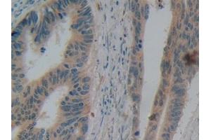 Immunohistochemistry (IHC) image for anti-Defensin beta 2 (BD-2) (AA 24-64) antibody (ABIN7430777)
