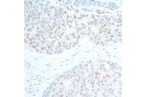 Immunohistochemistry (IHC) image for anti-Suppressor of Ty 6 Homolog (SUPT6H) (AA 425-475) antibody (ABIN7453850)