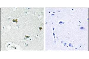 Immunohistochemistry analysis of paraffin-embedded human brain tissue, using BAD (Ab-91/128) Antibody. (BAD Antikörper  (AA 61-110))