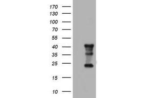 Image no. 8 for anti-Transmembrane Protein 173 (TMEM173) antibody (ABIN1501428) (STING/TMEM173 Antikörper)