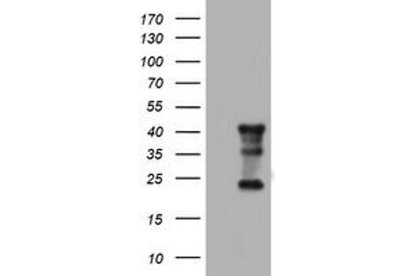 STING/TMEM173 anticorps