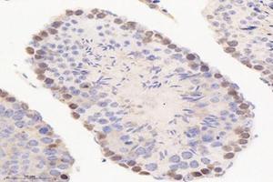 Immunohistochemistry analysis of paraffin-embedded mouse testis using,PME-1 (ABIN7075286) at dilution of 1: 2000 (PPME1 Antikörper)