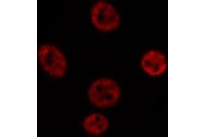 ABIN6269269 staining Hep G2 cells by IF/ICC. (SOX9 Antikörper)