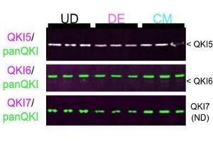 Western blot of protein extracted from UD hESCs, DE cells, and CM cells probed with antibodies for QKI5 (magenta, top panel) and panQKI (green), QKI6 (magenta, middle panel) and panQKI (green), or QKI7 (magenta, bottom panel, ND denotes not detectable) and panQKI (green).