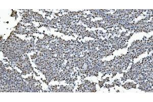 IHC analysis of GRX2/GLRX2 using anti-GRX2/GLRX2 antibody (ABIN7599022).