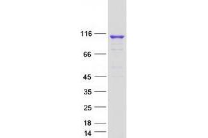Validation with Western Blot (OGDHL Protein (Transcript Variant 1) (Myc-DYKDDDDK Tag))