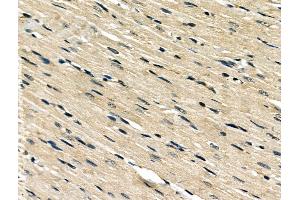 ABIN6260195 and ABIN6266499 at 1/100 staining Rat heart tissue by IHC-P. (BAK1 Antikörper  (N-Term))