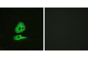 Peptide - +Western blot analysis of extracts from COLO205 cells, using GLR antibody. (GLRa2 Antikörper  (Internal Region))