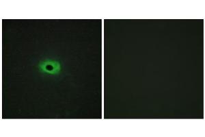 Immunofluorescence analysis of HeLa cells, using Syndecan4 (epitope around residue 179) antibody. (SDC4 Antikörper  (Ser179))