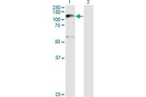 Western Blot analysis of XPO5 expression in transfected 293T cell line by XPO5 monoclonal antibody (M01A), clone 2C5-1B3. (XPO5 Antikörper  (AA 1-280))