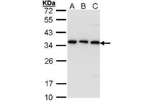WB Image Sample (30 ug of whole cell lysate) A: A431 , B: H1299 C: Hela 12% SDS PAGE antibody diluted at 1:1000 (TBCB Antikörper)