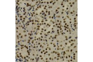 Immunohistochemistry of paraffin-embedded mouse kidney using NFKB2 antibody at dilution of 1:200 (400x lens). (NFKB2 Antikörper)