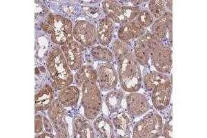 Immunohistochemical staining of human kidney with LHFPL2 polyclonal antibody  shows moderate cytoplasmic positivity in cells in tubules. (LHFPL2 Antikörper)