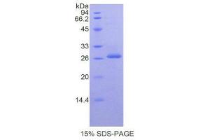 SDS-PAGE (SDS) image for Prostate Specific Antigen (PSA) (AA 39-261) protein (His tag) (ABIN1877792)